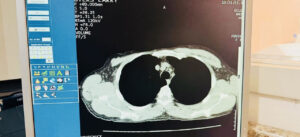 2011-Hitachi-Eclos-4